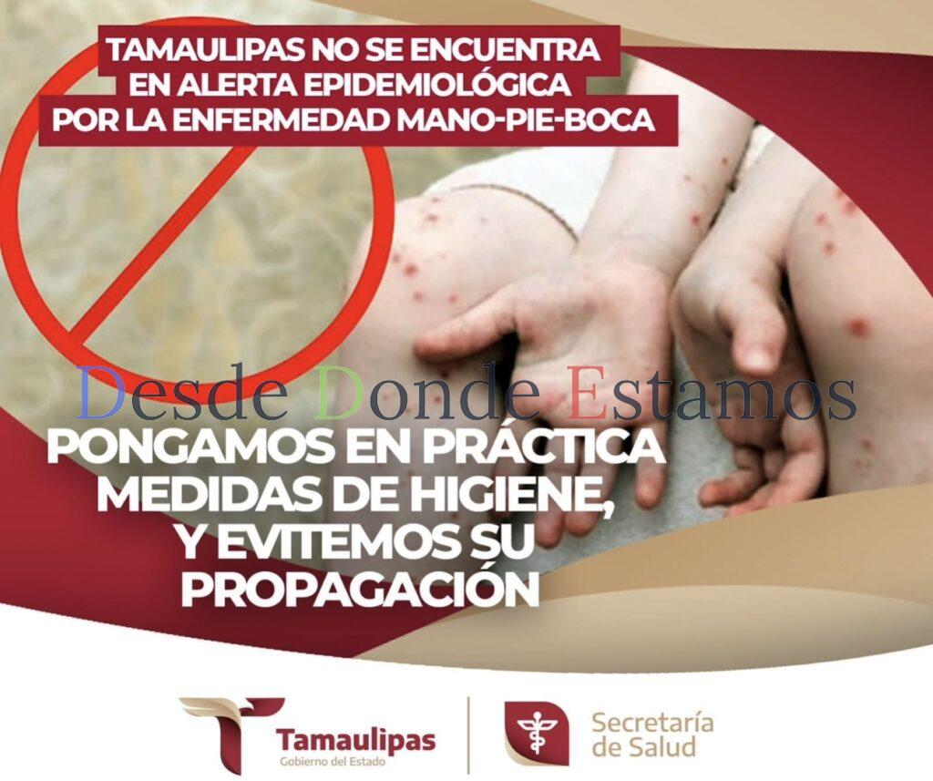 Enfermedad de boca-mano-pie no es grave: Salud